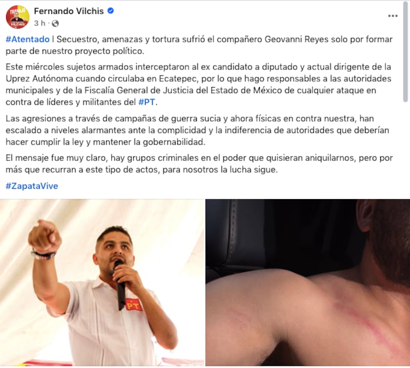 agresión