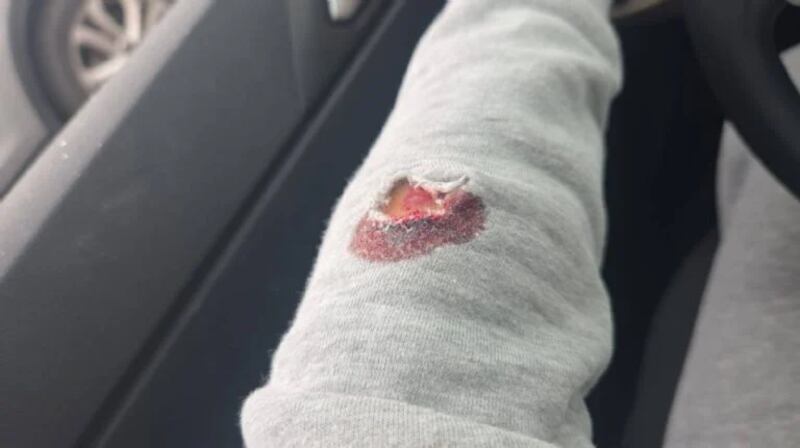 Tania Avendaño Servín, directora del DIF de Tecámac, fue herida por impacto de bala este 31 de diciembre. Herida de bala